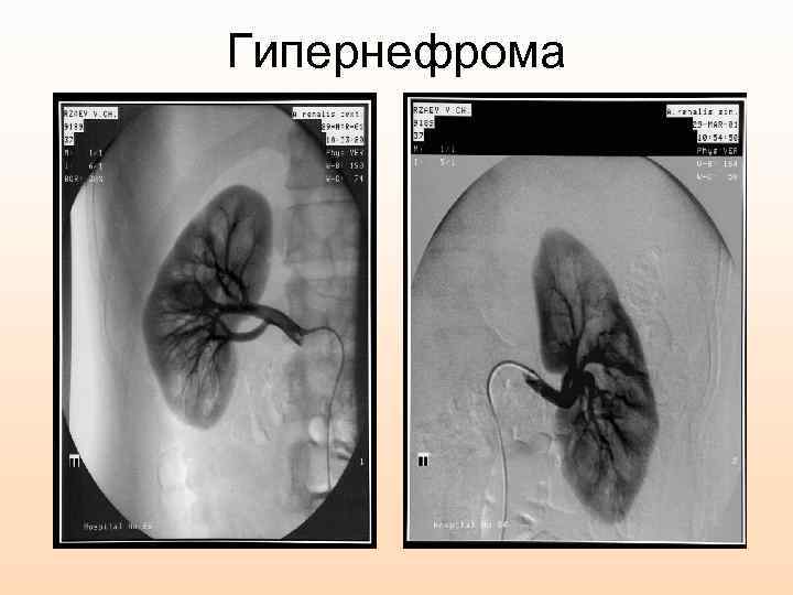 Методы лучевой диагностики в нефрологии презентация