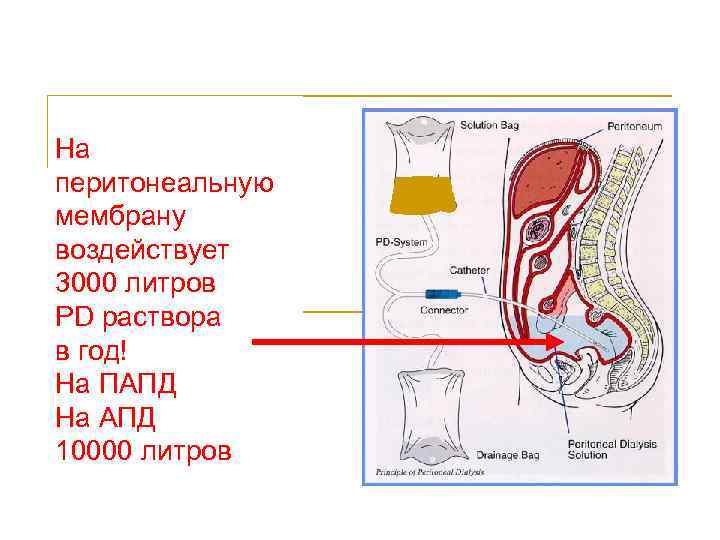 Перитонеальный диализ презентация