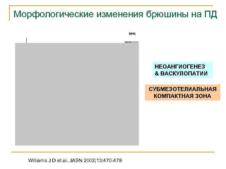 Морфологические изменения брюшины на ПД НЕОАНГИОГЕНЕЗ & ВАСКУЛОПАТИИ СУБМЕЗОТЕЛИАЛЬНАЯ КОМПАКТНАЯ ЗОНА Williams J D