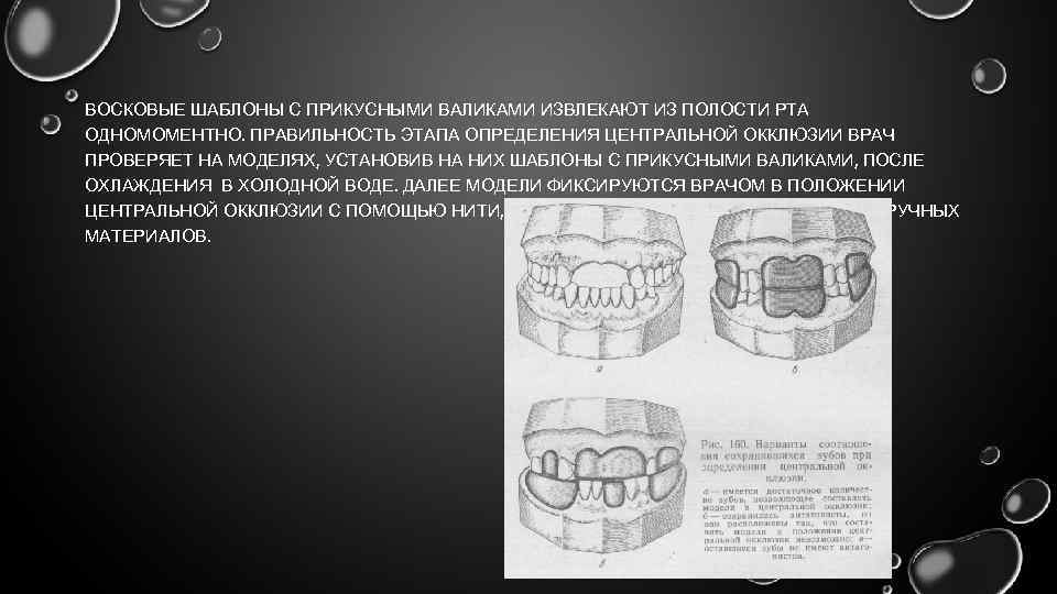 ВОСКОВЫЕ ШАБЛОНЫ С ПРИКУСНЫМИ ВАЛИКАМИ ИЗВЛЕКАЮТ ИЗ ПОЛОСТИ РТА ОДНОМОМЕНТНО. ПРАВИЛЬНОСТЬ ЭТАПА ОПРЕДЕЛЕНИЯ ЦЕНТРАЛЬНОЙ