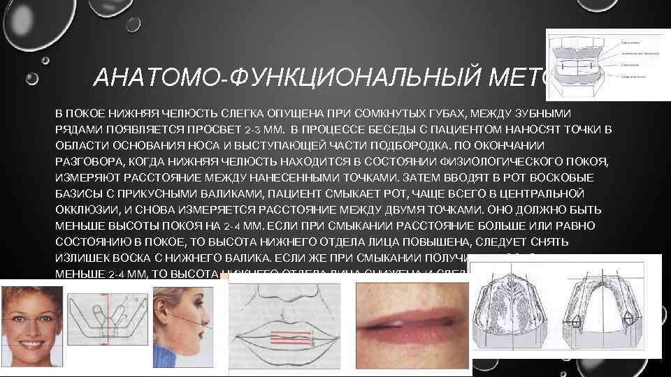 Высота покоя. Анатомический метод определения центрального соотношения челюстей. Анатомический метод определения центральной окклюзии. Метод определения центральной окклюзии. Определение центральной окклюзии.