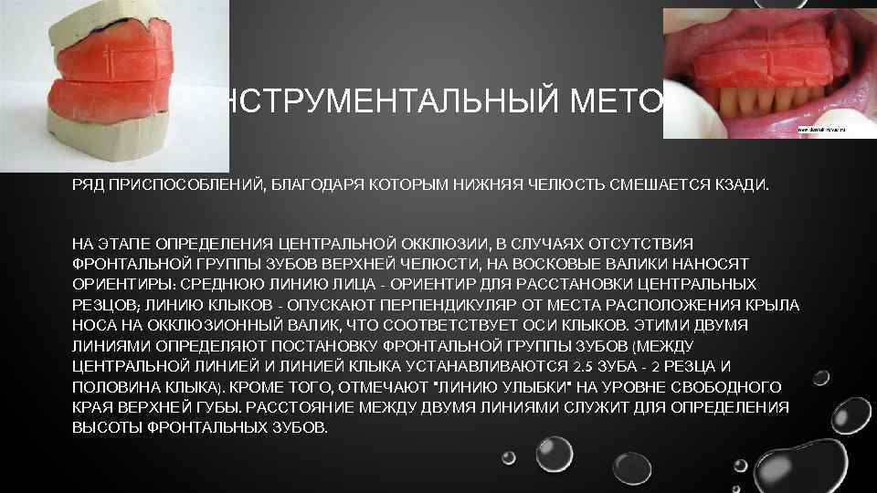 ИНСТРУМЕНТАЛЬНЫЙ МЕТОД РЯД ПРИСПОСОБЛЕНИЙ, БЛАГОДАРЯ КОТОРЫМ НИЖНЯЯ ЧЕЛЮСТЬ СМЕШАЕТСЯ КЗАДИ. НА ЭТАПЕ ОПРЕДЕЛЕНИЯ ЦЕНТРАЛЬНОЙ
