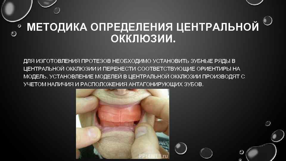 Презентация методы определения центрального соотношения челюстей