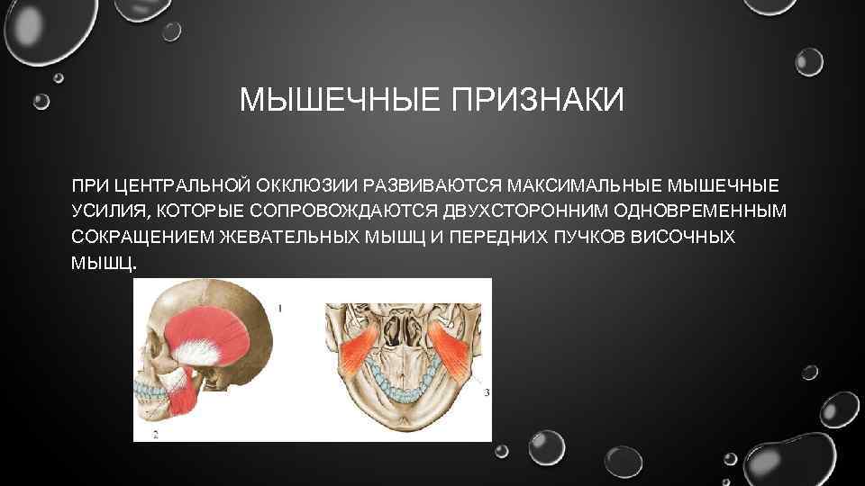 МЫШЕЧНЫЕ ПРИЗНАКИ ПРИ ЦЕНТРАЛЬНОЙ ОККЛЮЗИИ РАЗВИВАЮТСЯ МАКСИМАЛЬНЫЕ МЫШЕЧНЫЕ УСИЛИЯ, КОТОРЫЕ СОПРОВОЖДАЮТСЯ ДВУХСТОРОННИМ ОДНОВРЕМЕННЫМ СОКРАЩЕНИЕМ