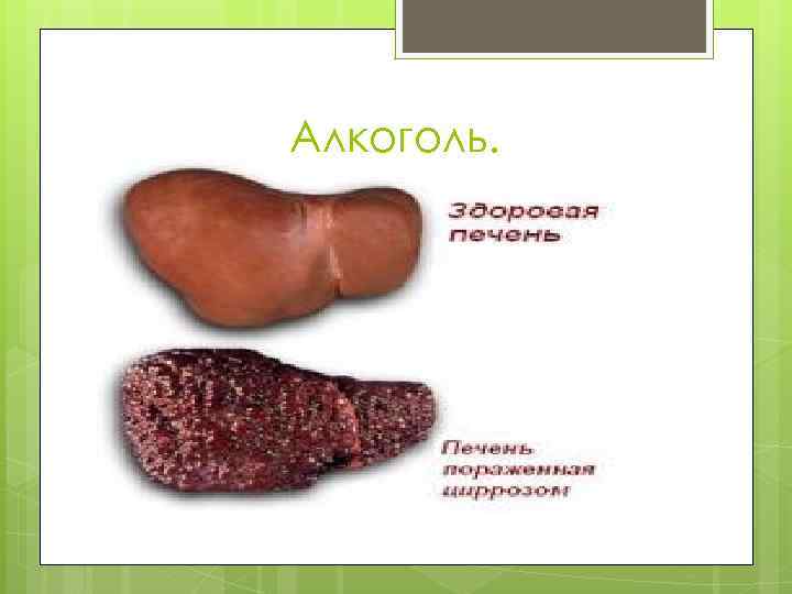 Алкоголь. Алкоголь — внутриклеточный яд, разрушающе действующий на все системы и органы человека. 