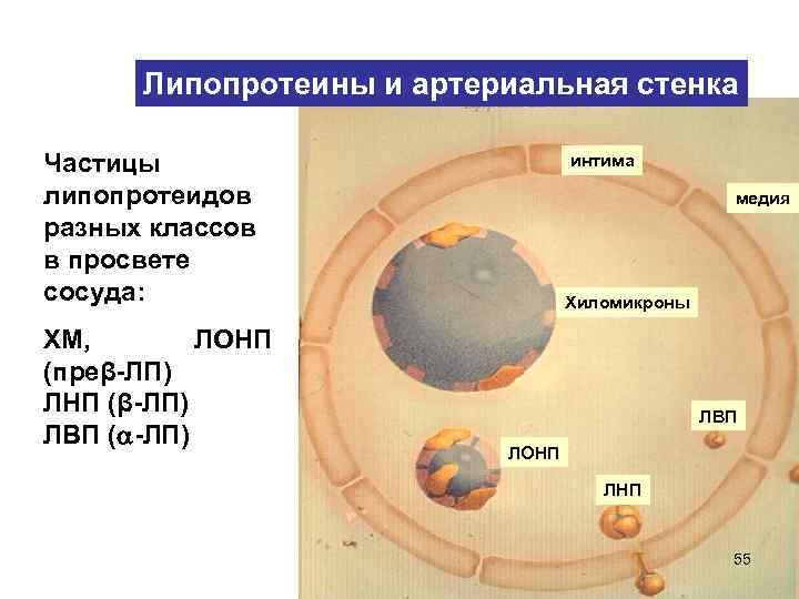 Липопротеины и артериальная стенка Частицы липопротеидов разных классов в просвете сосуда: ХМ, ЛОНП (преβ-ЛП)