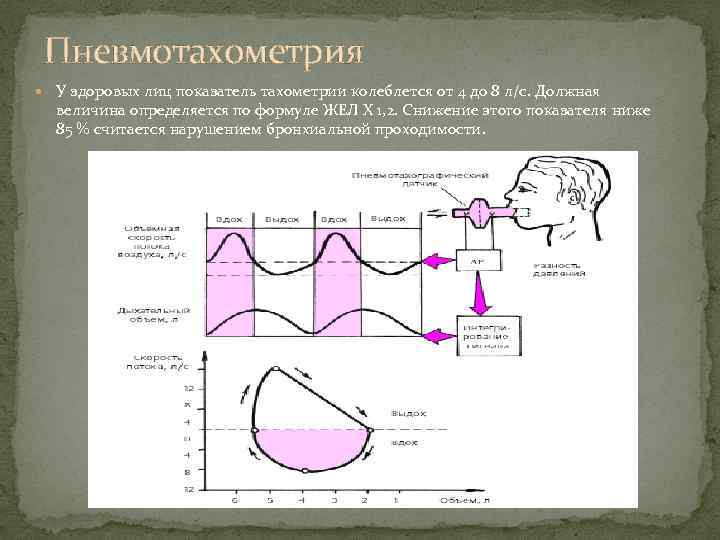 Пневмотахометрия У здоровых лиц показатель тахометрии колеблется от 4 до 8 л/с. Должная величина