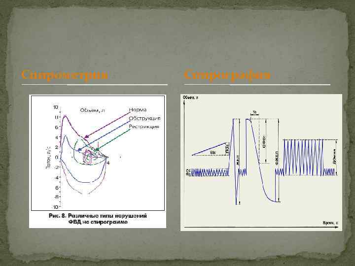 Спирометрия Спирография 