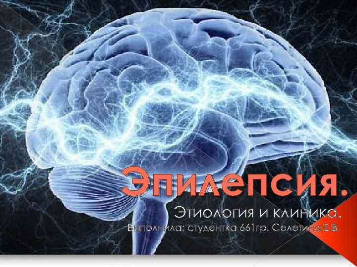 Эпилепсия. Этиология и клиника. Выполнила: студентка 661 гр. Селетина Е. В. 