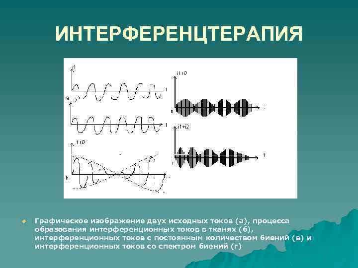 ИНТЕРФЕРЕНЦТЕРАПИЯ u Графическое изображение двух исходных токов (а), процесса образования интерференционных токов в тканях