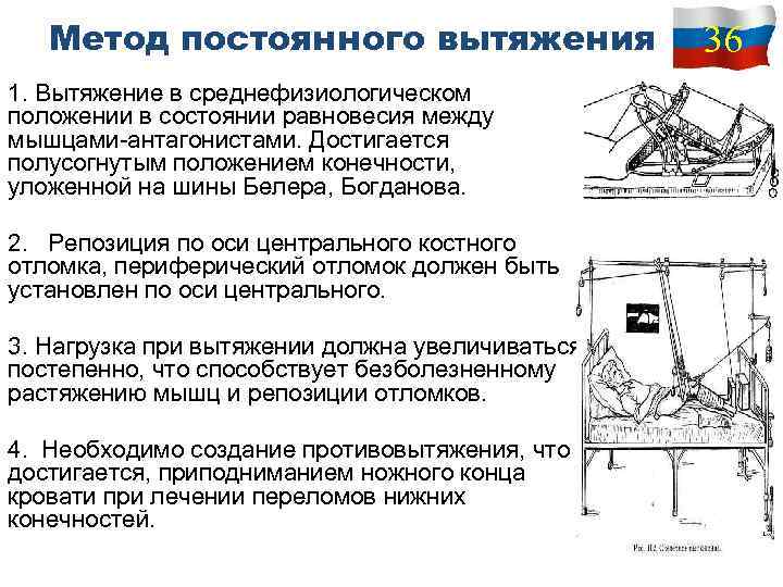 Метод постоянного вытяжения 1. Вытяжение в среднефизиологическом положении в состоянии равновесия между мышцами антагонистами.