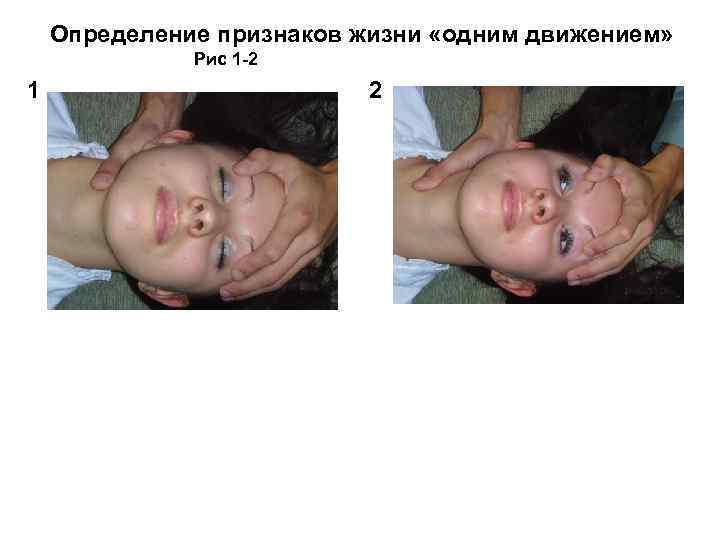 Определение признаков жизни «одним движением» Рис 1 -2 1 2 