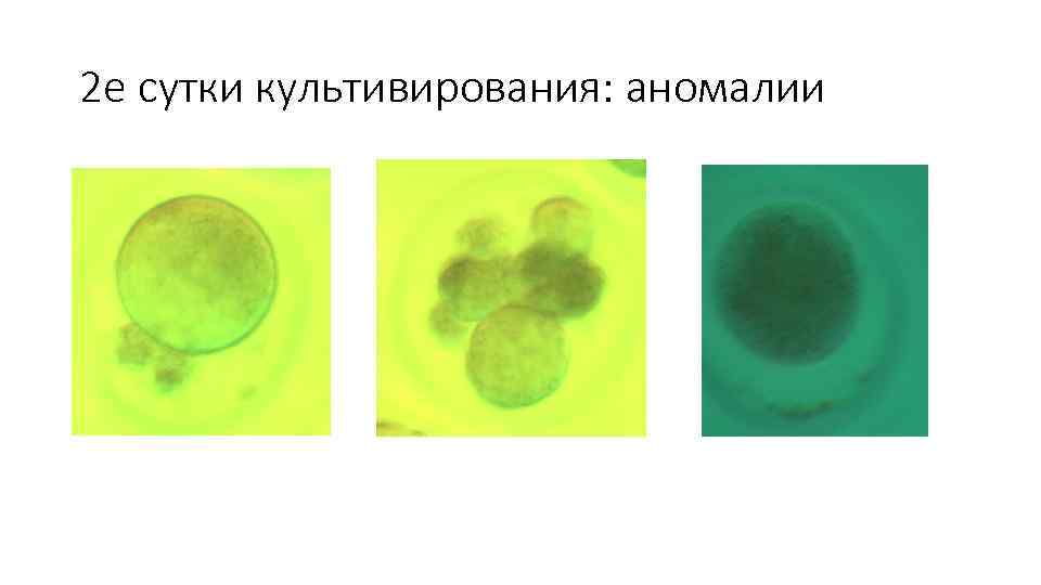 2 е сутки культивирования: аномалии 