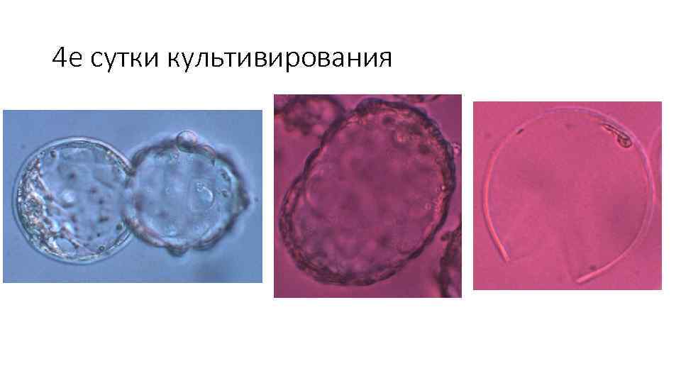 4 е сутки культивирования 