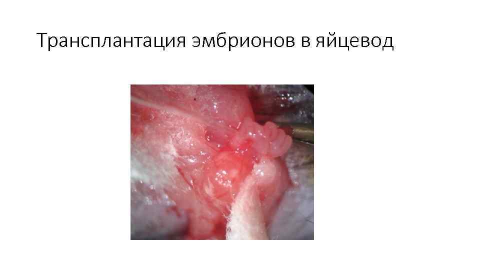 Трансплантация эмбрионов в яйцевод 
