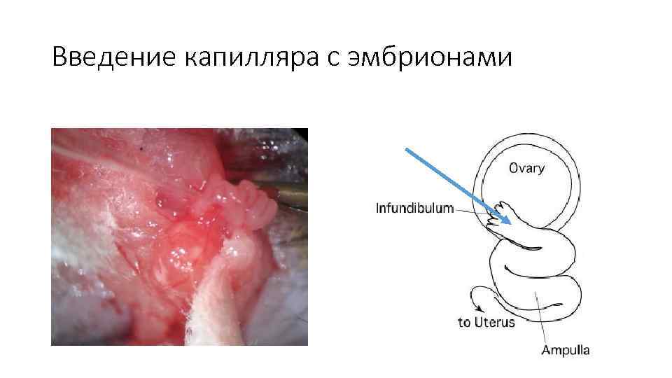 Введение капилляра с эмбрионами 