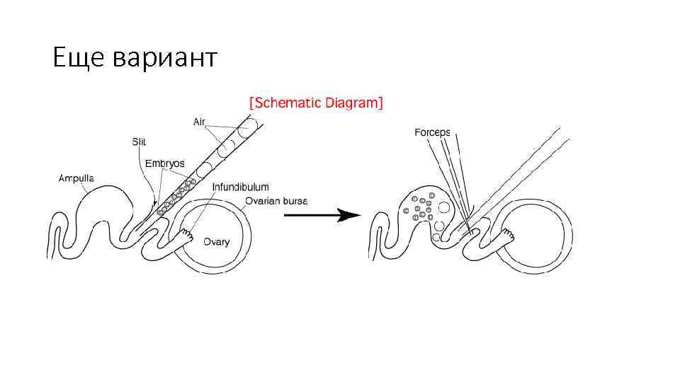 Еще вариант 