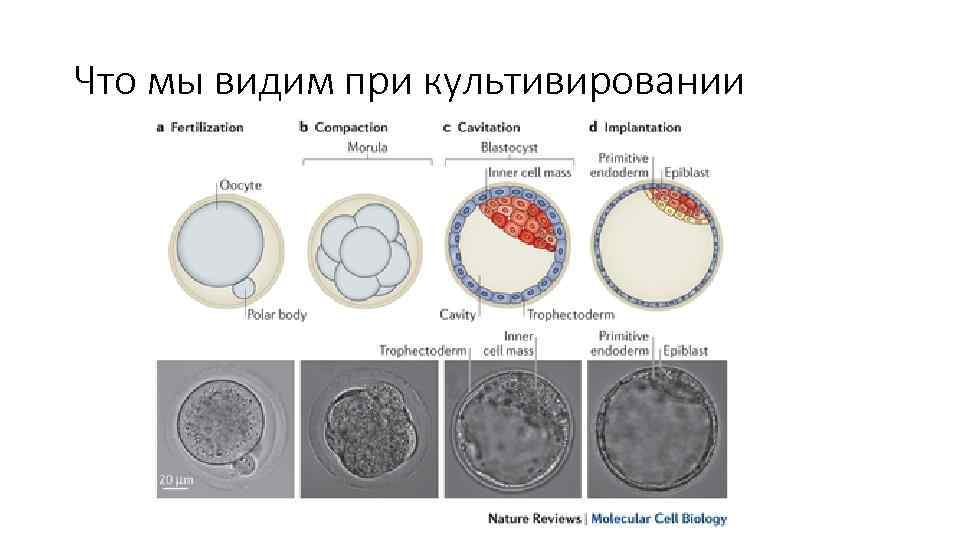Что мы видим при культивировании 