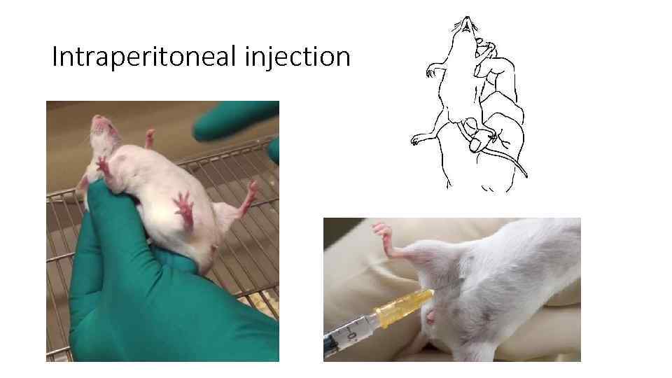Intraperitoneal injection 