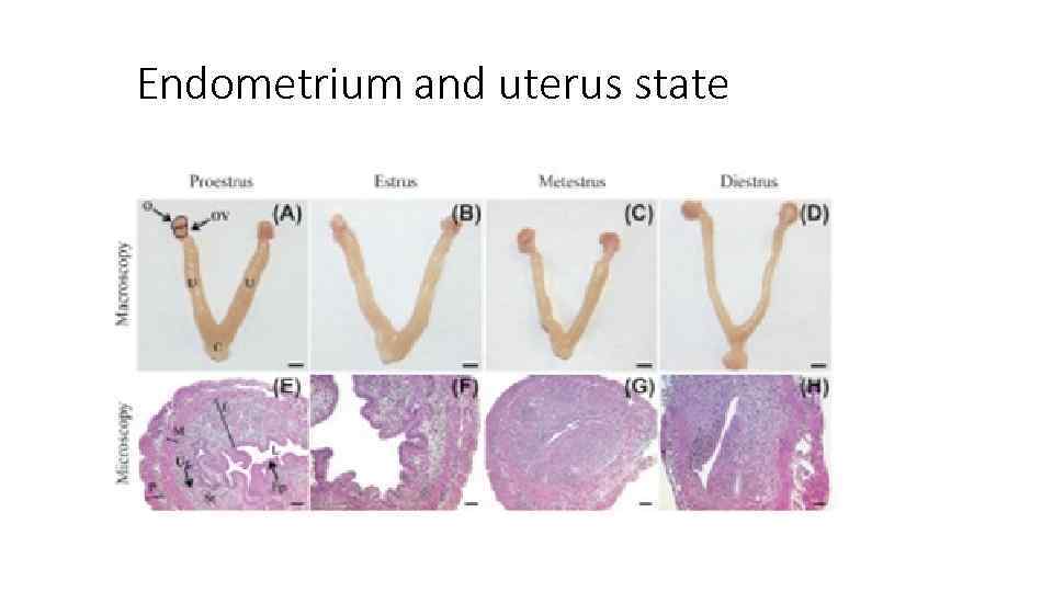 Endometrium and uterus state 