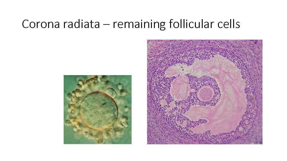 Corona radiata – remaining follicular cells 
