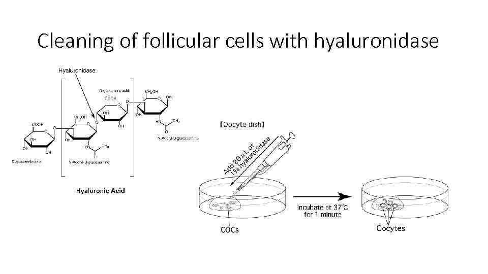 Cleaning of follicular cells with hyaluronidase 