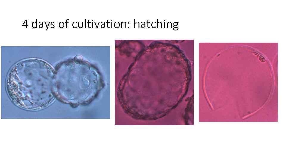 4 days of cultivation: hatching 