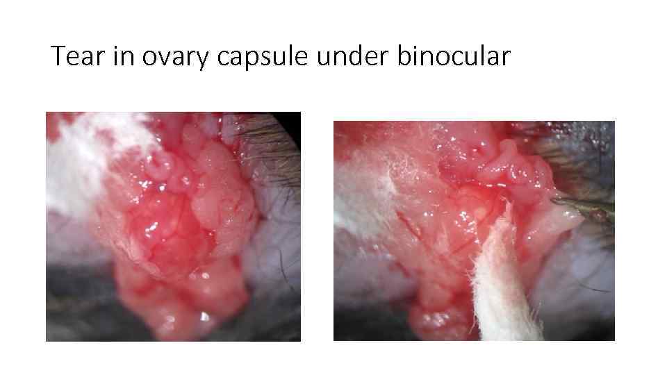 Tear in ovary capsule under binocular 