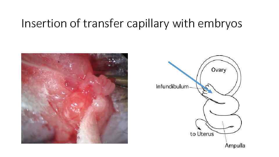 Insertion of transfer capillary with embryos 