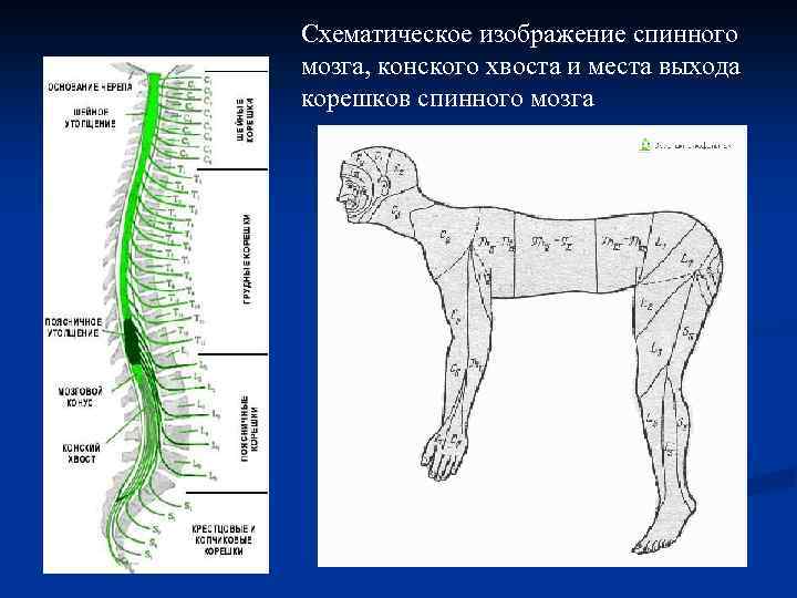 Схематическое изображение спинного мозга, конского хвоста и места выхода корешков спинного мозга 