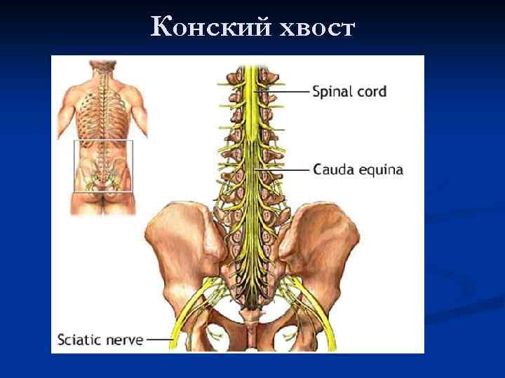 Конский хвост 