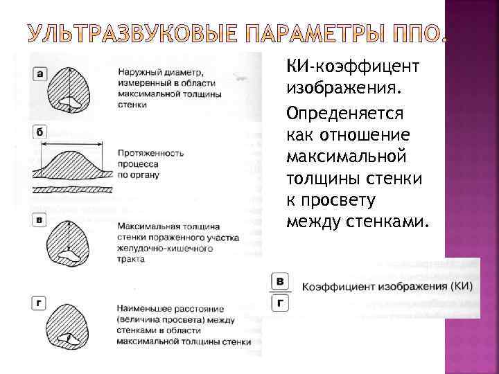 КИ-коэффицент изображения. Опреденяется как отношение максимальной толщины стенки к просвету между стенками. 