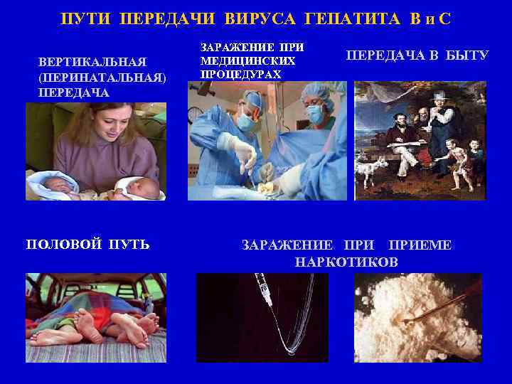 ПУТИ ПЕРЕДАЧИ ВИРУСА ГЕПАТИТА В и С ВЕРТИКАЛЬНАЯ (ПЕРИНАТАЛЬНАЯ) ПЕРЕДАЧА ПОЛОВОЙ ПУТЬ ЗАРАЖЕНИЕ ПРИ