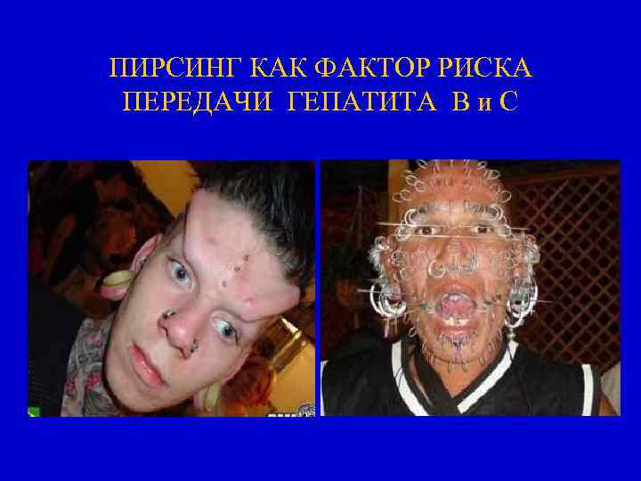 ПИРСИНГ КАК ФАКТОР РИСКА ПЕРЕДАЧИ ГЕПАТИТА В и С 