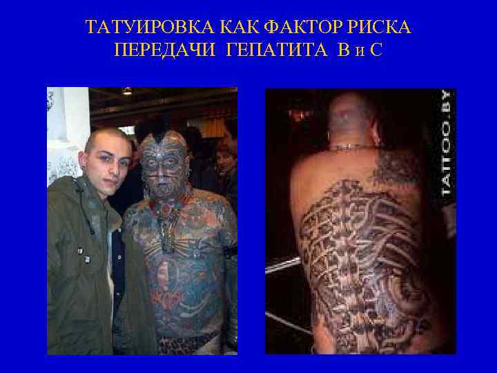 ТАТУИРОВКА КАК ФАКТОР РИСКА ПЕРЕДАЧИ ГЕПАТИТА В и С 