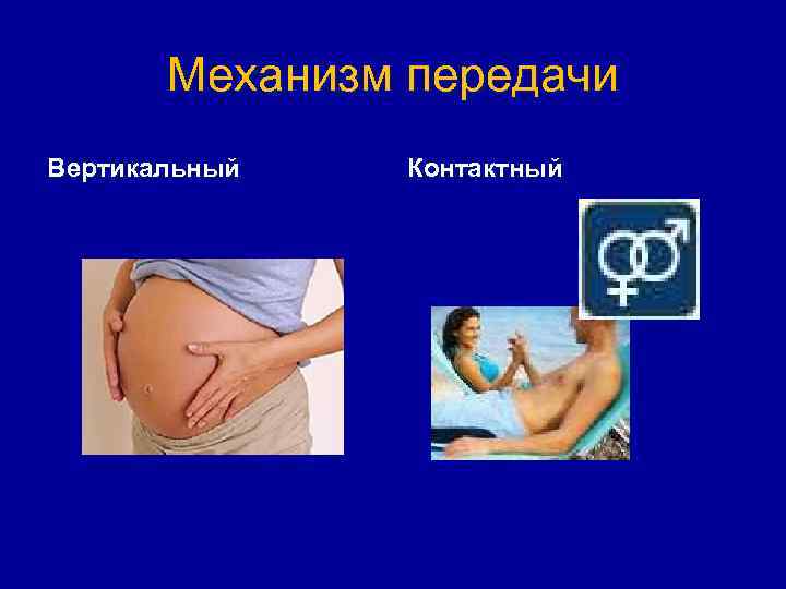 Механизм передачи Вертикальный Контактный 