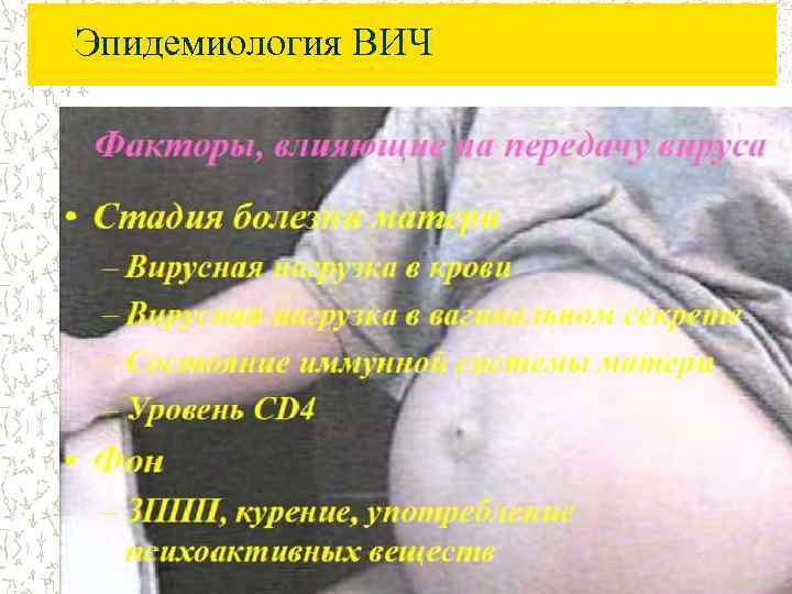 Эпидемиология ВИЧ 