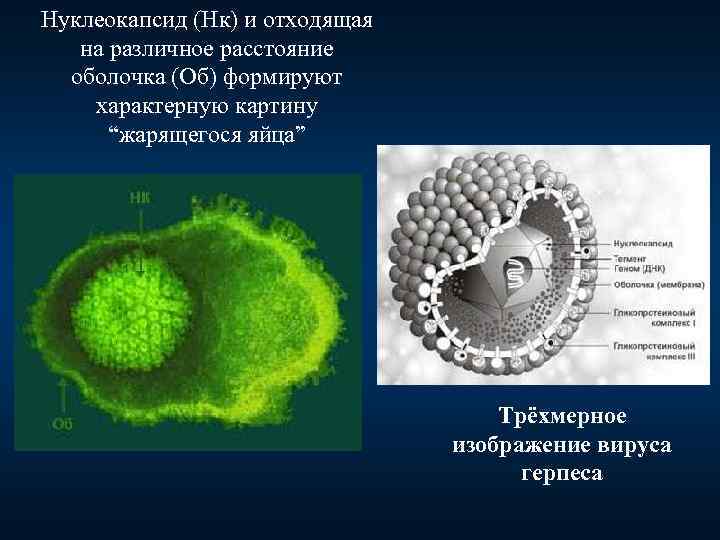 Нуклеокапсид (Нк) и отходящая на различное расстояние оболочка (Об) формируют характерную картину “жарящегося яйца”