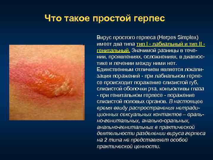 Что такое простой герпес Вирус простого герпеса (Herpes Simplex) имеет два тип I лабиальный