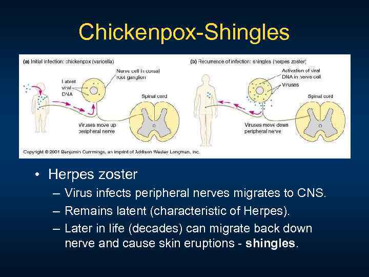 Chickenpox Shingles • Herpes zoster – Virus infects peripheral nerves migrates to CNS. –