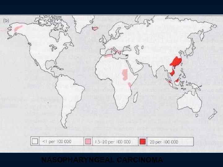 NASOPHARYNGEAL CARCINOMA 
