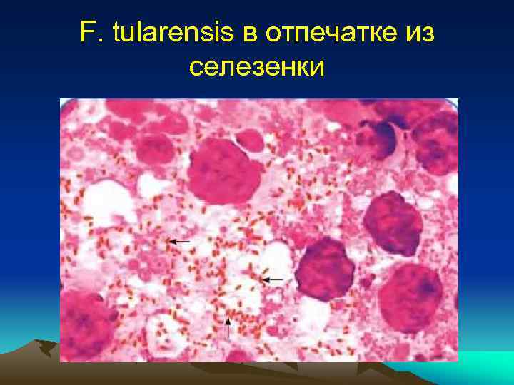 F. tularensis в отпечатке из селезенки 