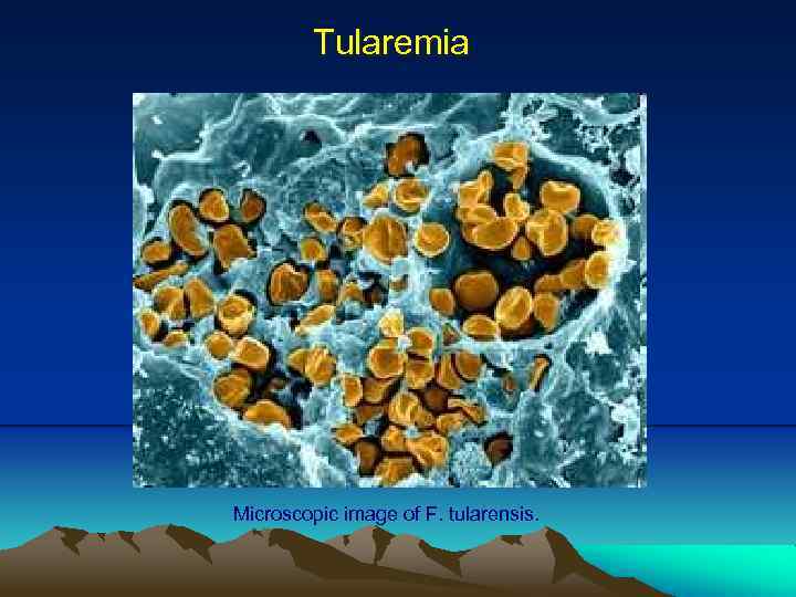 Tularemia Microscopic image of F. tularensis. 