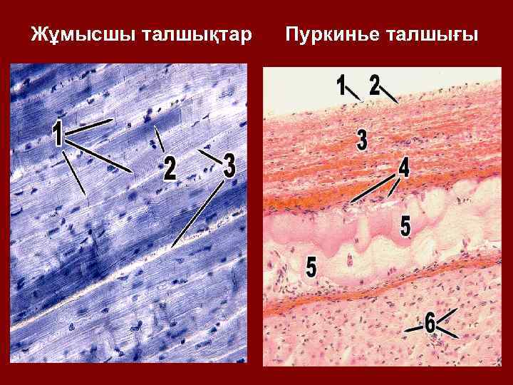 Волокна пуркинье гистология рисунок