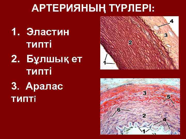 АРТЕРИЯНЫҢ ТҮРЛЕРІ: 1. Эластин типті 2. Бұлшық ет типті 3. Аралас типті 17 