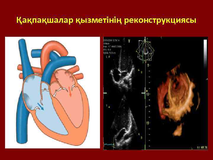 Қақпақшалар қызметінің реконструкциясы 