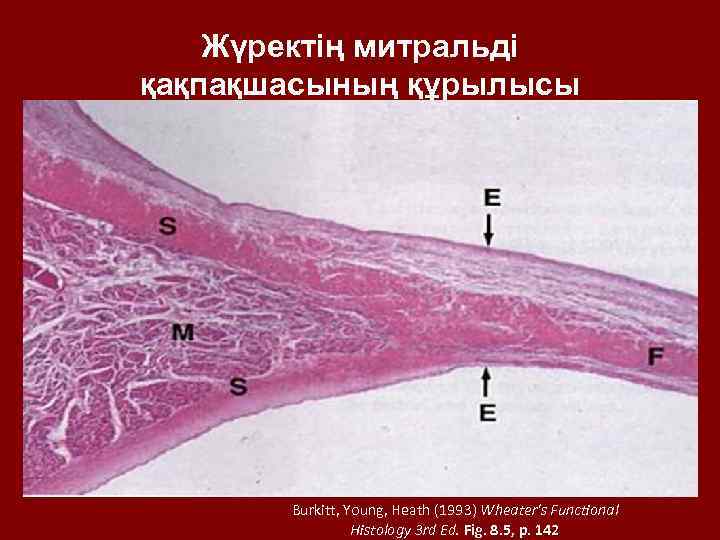 Жүректің митральді қақпақшасының құрылысы Burkitt, Young, Heath (1993) Wheater's Functional Histology 3 rd Ed.