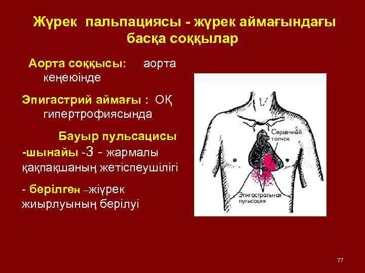  Жүрек пальпациясы - жүрек аймағындағы басқа соққылар Аорта соққысы: кеңеюінде аорта Эпигастрий аймағы