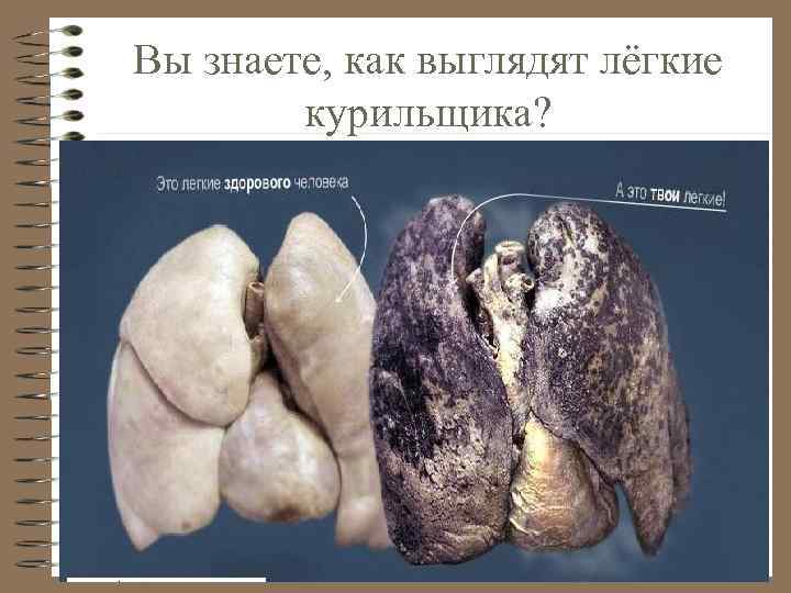 Вы знаете, как выглядят лёгкие курильщика? 