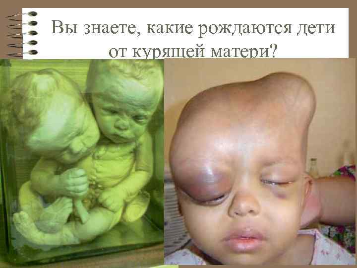 Вы знаете, какие рождаются дети от курящей матери? 